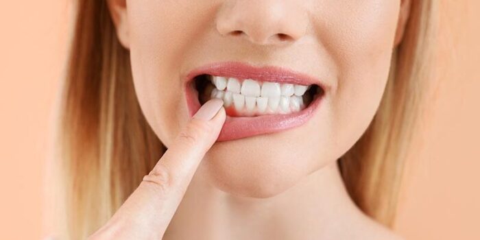 Beautiful woman with healthy teeth on color background, closeup